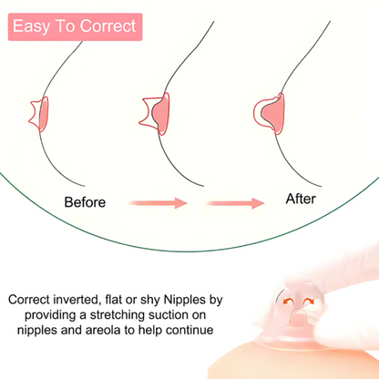 LACTEA NIPPLE CORRECTORS - SUPPLE CUPS